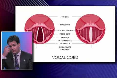 Anatomy of the Vocal Cords