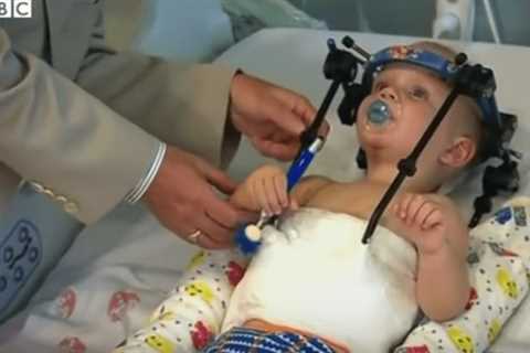 Toddler’s head reattached to spine after ‘internal decapitation’