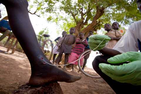 Jimmy Carter Took on the Awful Guinea Worm When No One Else Would — And Triumphed