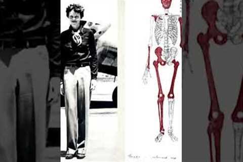 Scientists Find Amelia Earhart's Bones #shorts #ameliaearhart