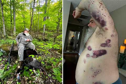 Takeaways from a Turkey Hunter Who Was Accidentally Shot by His Longtime Hunting Partner