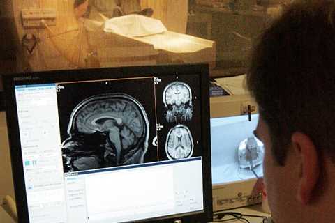 Doctors searching for the cause of a patient’s headaches found chopsticks in his brain. – •