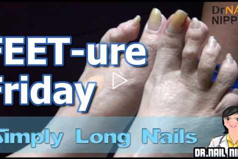 Long Toenails | FEET-ure Friday - Dr Nail Nipper (2024)