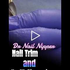 Nail Trim and Health Discussions