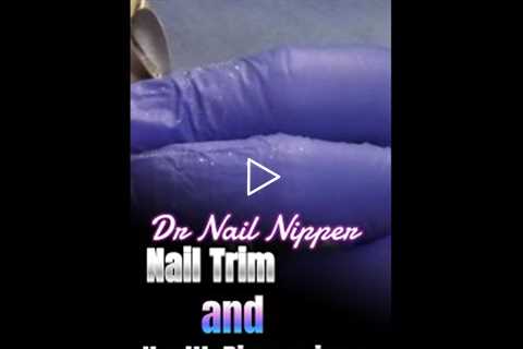 Nail Trim and Health Discussions