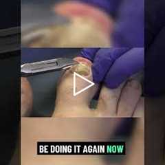 Embracing a Healthier Lifestyle After Retirement 🍏