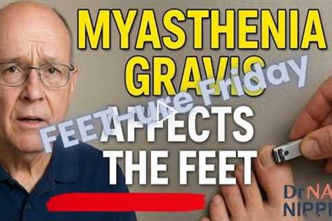 FEET-ure Friday | Living With Myasthenia Gravis: How MG Affects Balance, Fatigue & Foot Care
