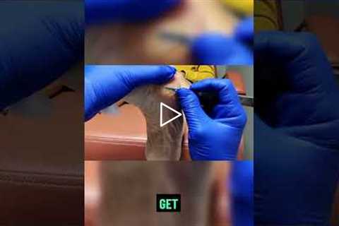 Dealing with Persistent Skin Bumps 🦶😬🔍 Here’s why trimming alone isn’t enough