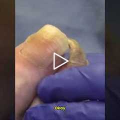 The Importance of Regular Nail Trimming 👣✂️