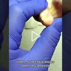 Why You Can't Trim Your Own Toenails