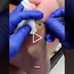 A Doctor’s Advice on Footwear for Your Job 👟