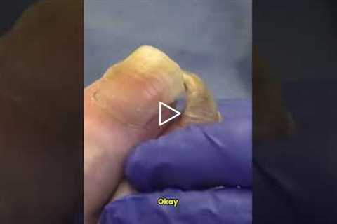 The Importance of Regular Nail Trimming 👣✂️