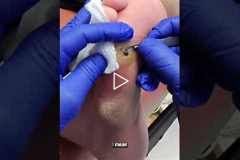 A Doctor’s Advice on Footwear for Your Job 👟