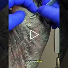 What’s Causing Shooting Foot Pain? ⚡🦶