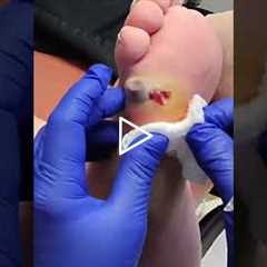 Treating an open wound the doctor's approach