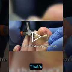 Nail Care Tips Avoiding Common Mistakes  #podiatry #foothealth #drnailnipper