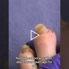 The Nail That's Been Damaged for Decades