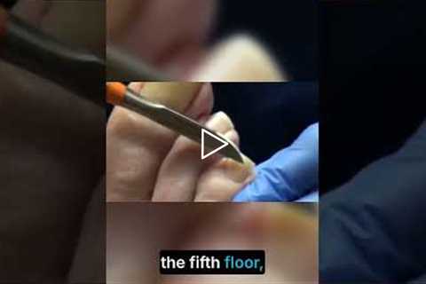 Take the Stairs: Small Changes for Big Health Gains!