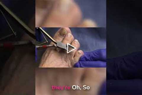 How Often Should You See a Podiatrist (Insurance Tips!)