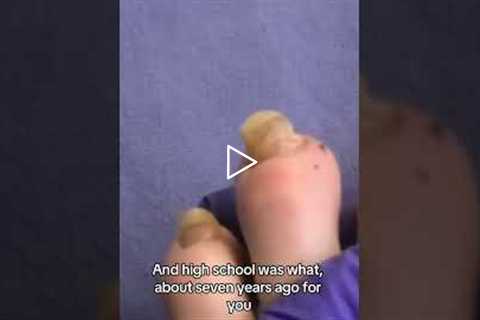 The Nail That's Been Damaged for Decades