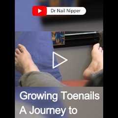 Dr. Nail Nipper Tackles Overgrown Toenails #pedicure #satisfying