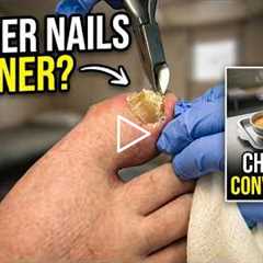 FEET-ure Friday | Nails and Dinner in the Shelter