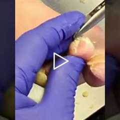 Why choose podiatry A doctor shares their journey into a field focused on quality of life