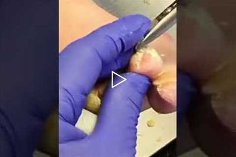 Why choose podiatry A doctor shares their journey into a field focused on quality of life