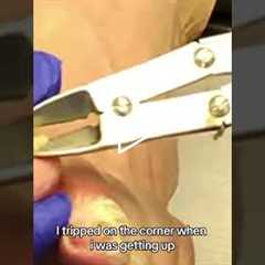 Tripped and flew into a dining room table