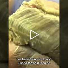 Thick Nails, No Way to Reach Them #podiatry #satisfying #toenailcare