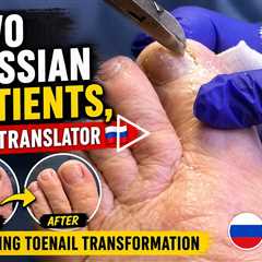 Two Russian Patients, One Translator 🇷🇺 | Satisfying Toenail Transformation
