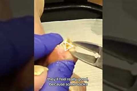 Can't trim toenails