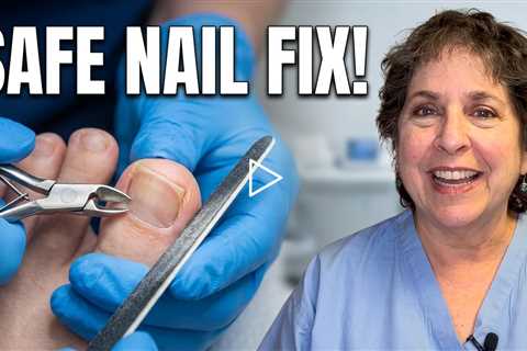 Two Toenail Cases Back-to-Back | The Unexpected Moment