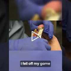 The Big Toe Dilemma A Carnie's Journey #podiatry #drnailnipper #satisfying #footcare
