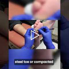 Hidden Wound Under a Callus? 😳 Foot Care Visit & Tough Work Boots