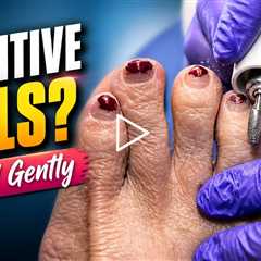 Removing Thick Nail Polish - Proper Toenail Trimming & Shaping