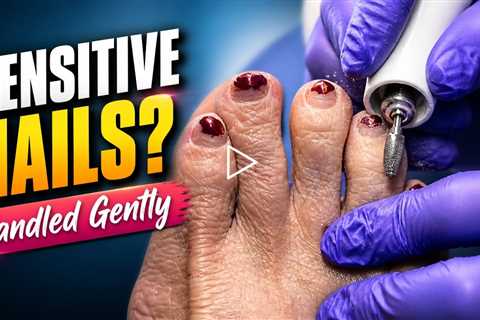 Removing Thick Nail Polish - Proper Toenail Trimming & Shaping
