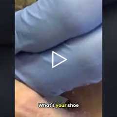 I Blamed My Boots for My Long Toenails!  #podiatry #footcare