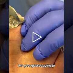 That Came Off in ONE Piece 😳🦶  #footcare #foothealth #drnailnipper