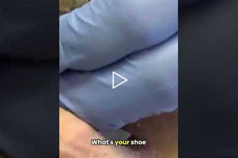 I Blamed My Boots for My Long Toenails!  #podiatry #footcare