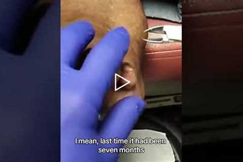 Patient's Hilarious Reason for a Podiatrist Visit