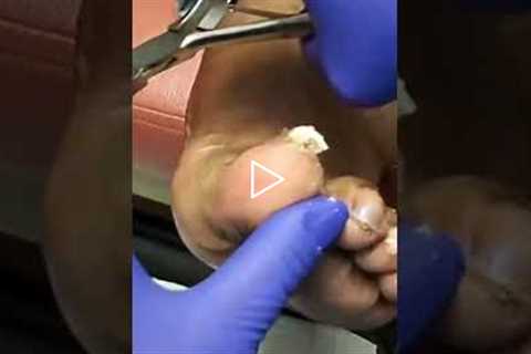 A Podiatrist's Plan for a Perfect Vacation