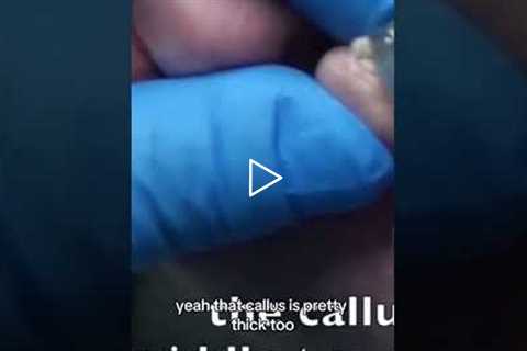 Why Your Feet Are So Uncomfortable