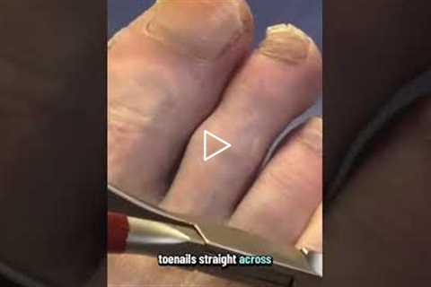 They say to cut toenails straight across, but I trim the edges