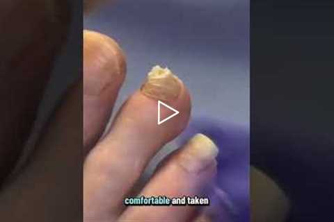 If you can reach your foot and see, it's fine, but always have antibiotic ointment