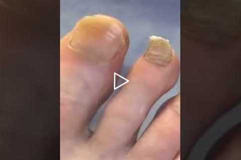 I've heard of the tooth fairy, but never the toenail fairy. I was intimidated about trimming a nail