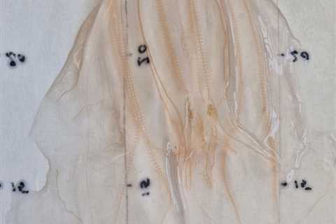 Ribbegople, Rippenqualle or Comb Jelly: Whatever You Call Mnemiopsis leidyi, You Should Be Concerned