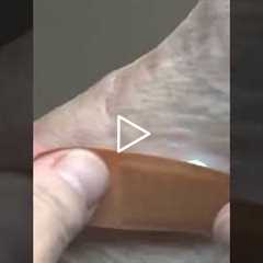 Why your foot sore won't heal (and how to fix it) #health #wounds #tipsforyou