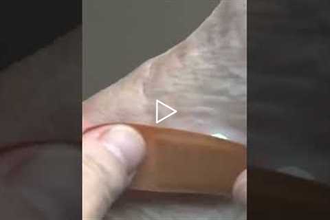 Why your foot sore won't heal (and how to fix it) #health #wounds #tipsforyou